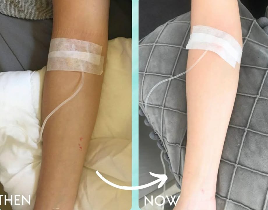 Glutathione Drip & Push client result 3